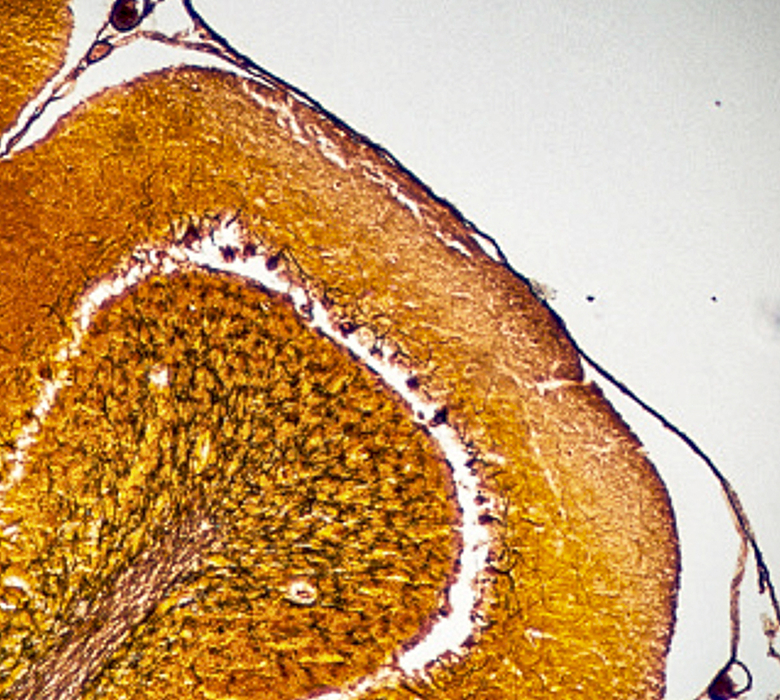 A brain tissue image shows the link between plastic in the brain and neurodegenerative disorders.